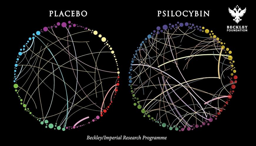 comparison between placebo and psilocybin of brain connectivity using circles and lines to represent relative connectivity